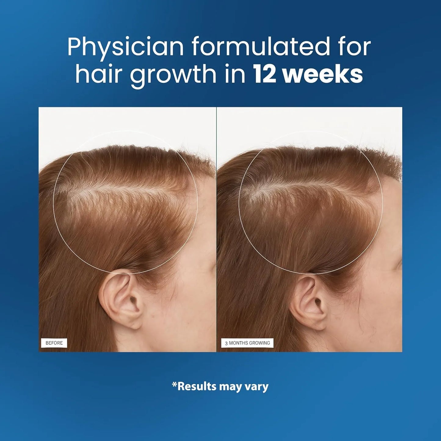 Kavelen™ Scalp Reset Ampoule