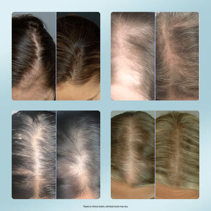 Kavelen™ Scalp Reset Ampoule