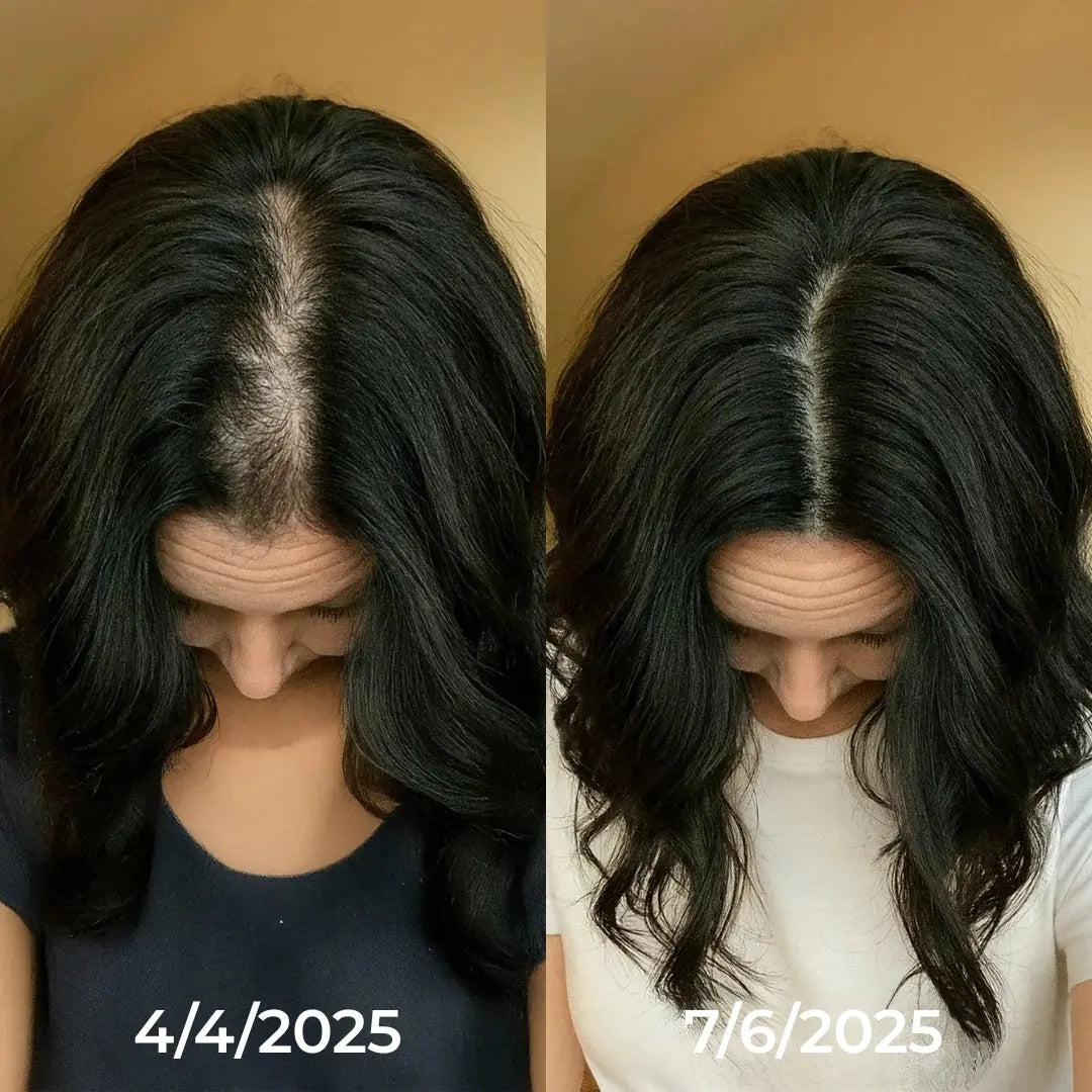 Kavelen™ Scalp Reset Ampoule