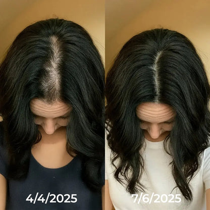 Kavelen™ Scalp Reset Ampoule